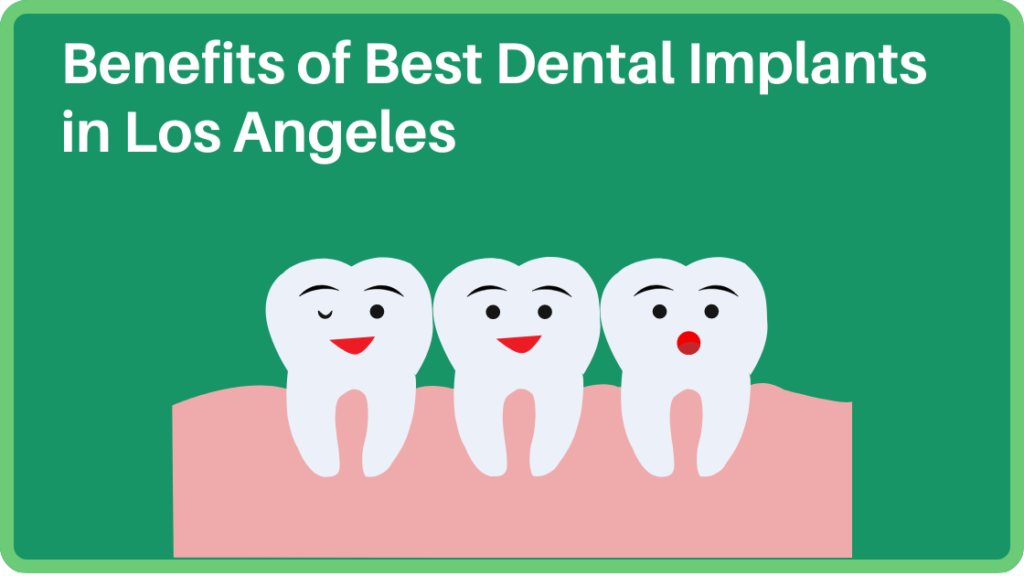 Benefits of Best Dental Implants in Los Angeles