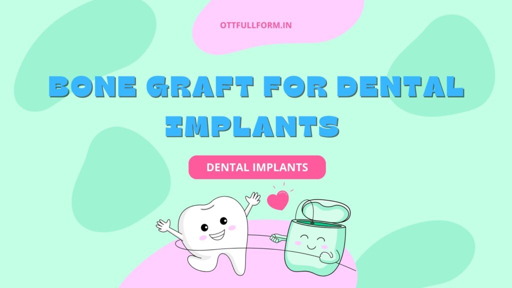 Bone Graft for Dental Implants: