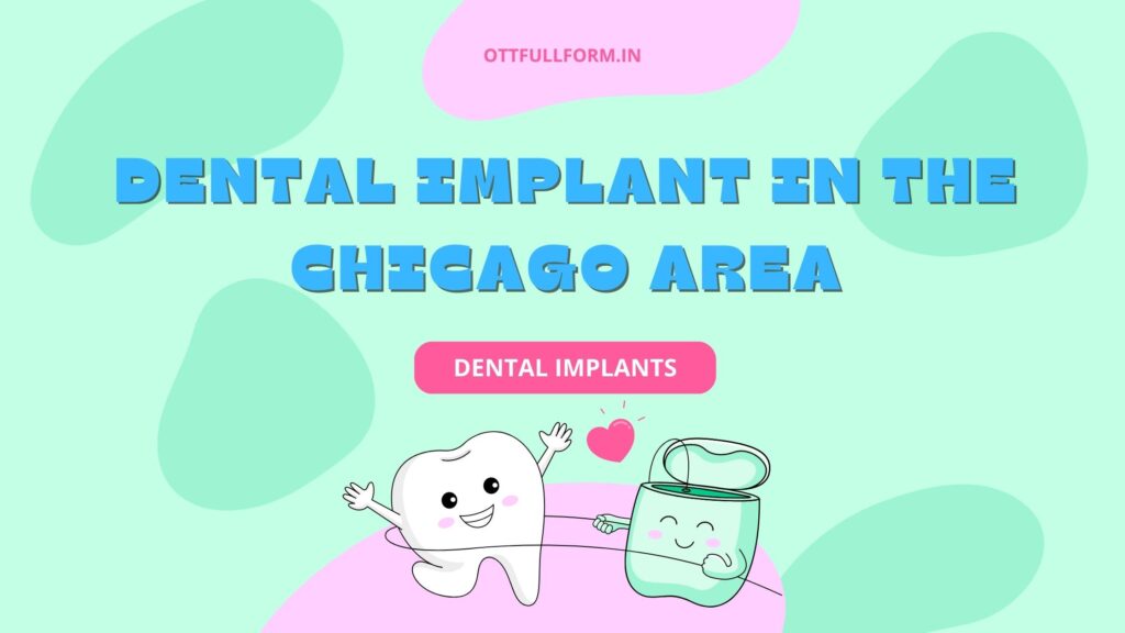 Dental Implants in the Chicago Area A Comprehensive Guide