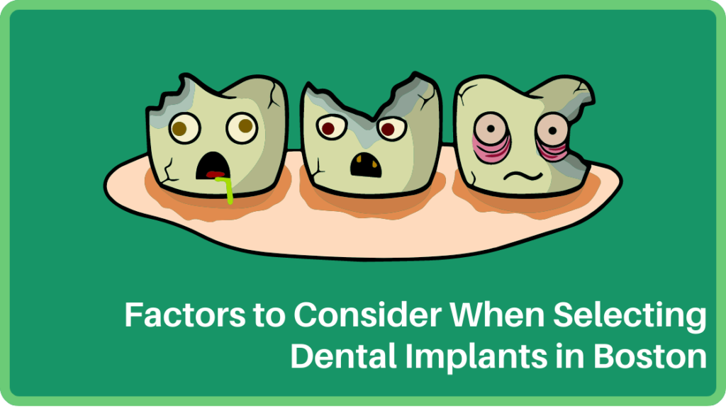 Factors to Consider When Selecting Dental Implants in Boston