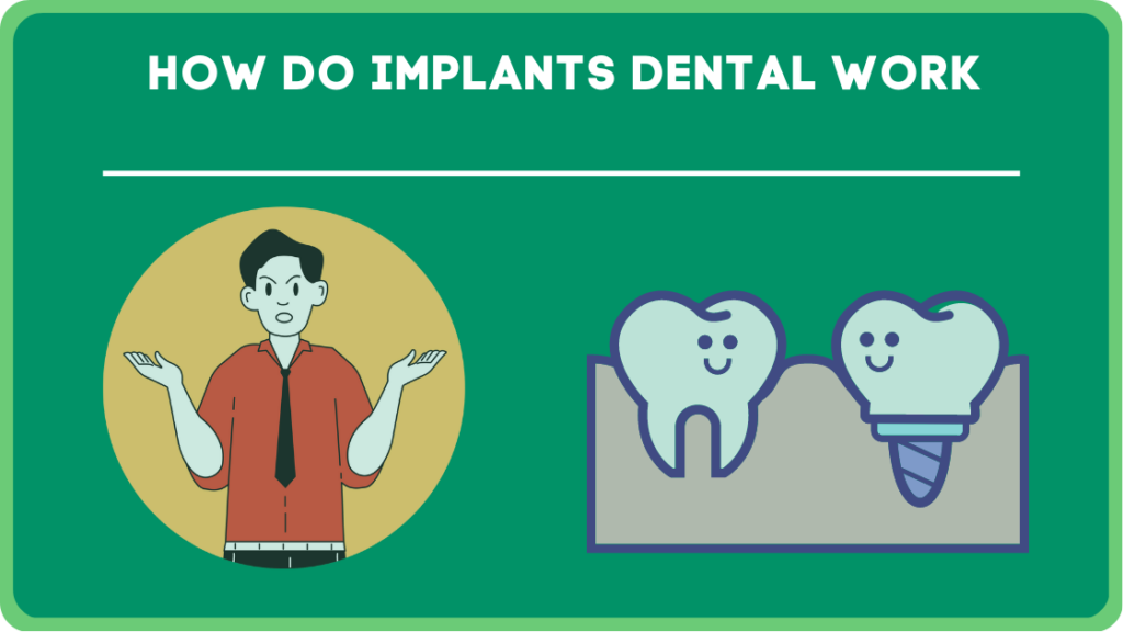 How Do Implants Dental Work