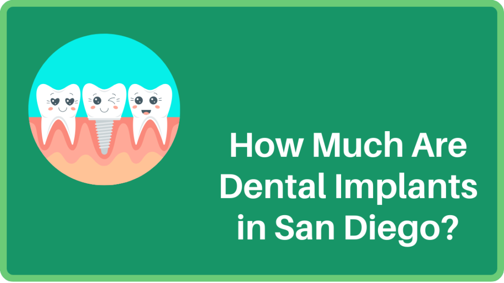 How Much Are Dental Implants in San Diego?
