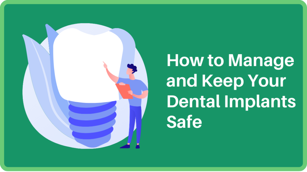 How to Manage and Keep Your Dental Implants Safe