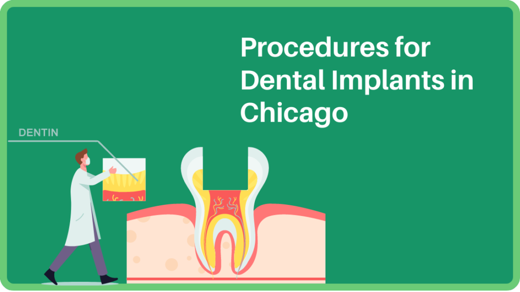 Procedures for Dental Implants in Chicago