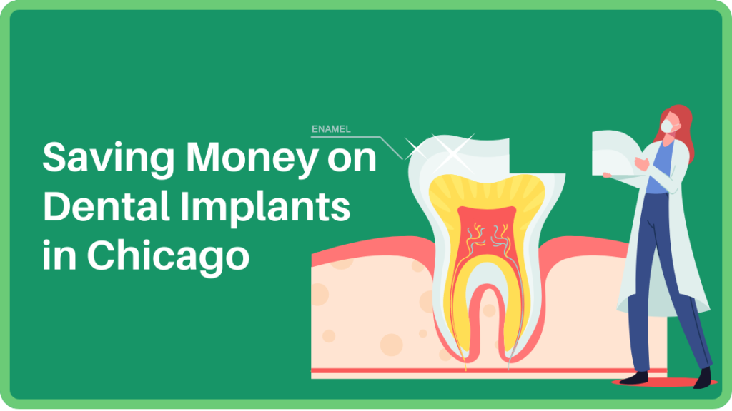 Saving Money on Dental Implants in Chicago