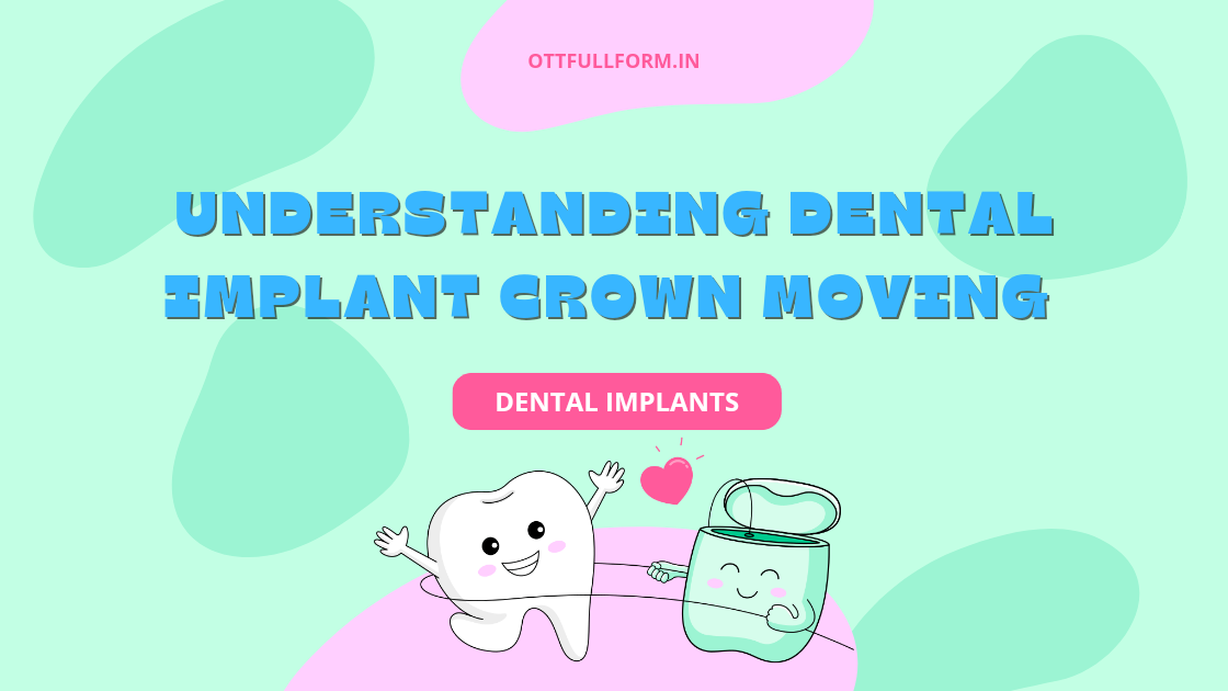 THe Understanding Dental Implant Crown Moving 2023
