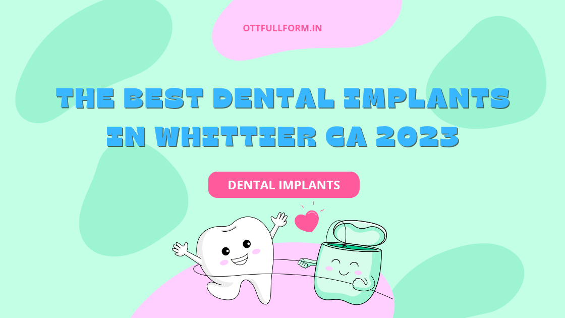 The Best Dental Implants in Whittier CA 2023