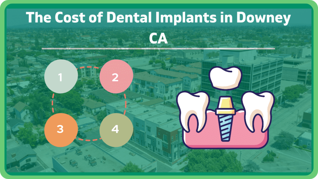 The Cost of Dental Implants in Downey CA