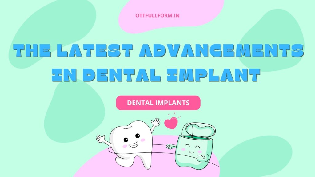 The Latest Advancements in Dental Implants: What You Need to Know in 2023