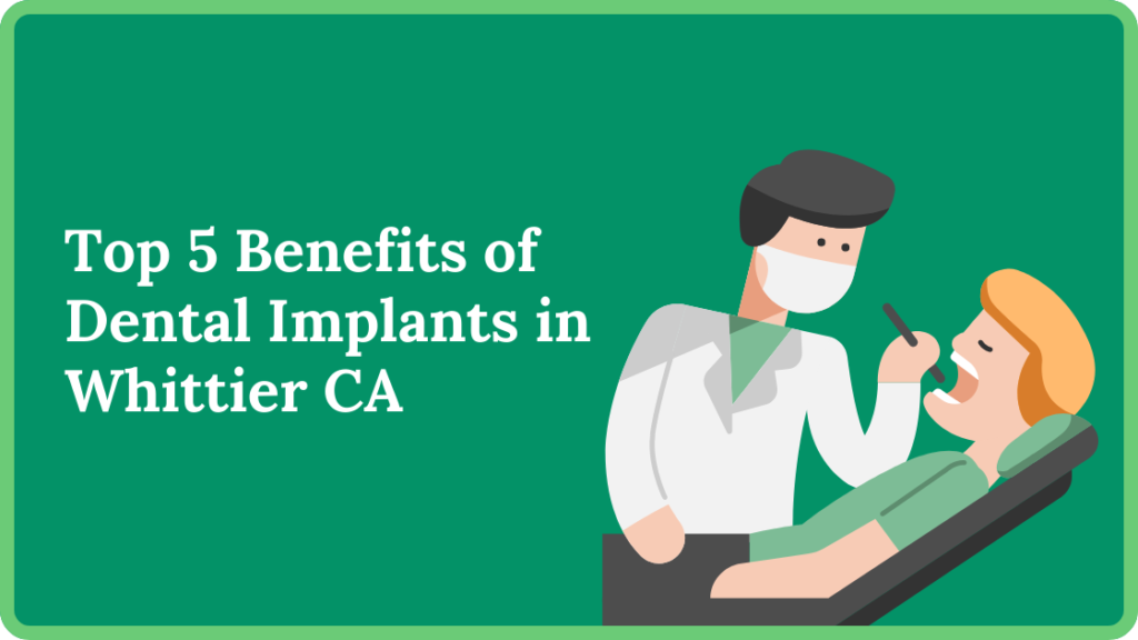 Top 5 Benefits of Dental Implants in Whittier CA