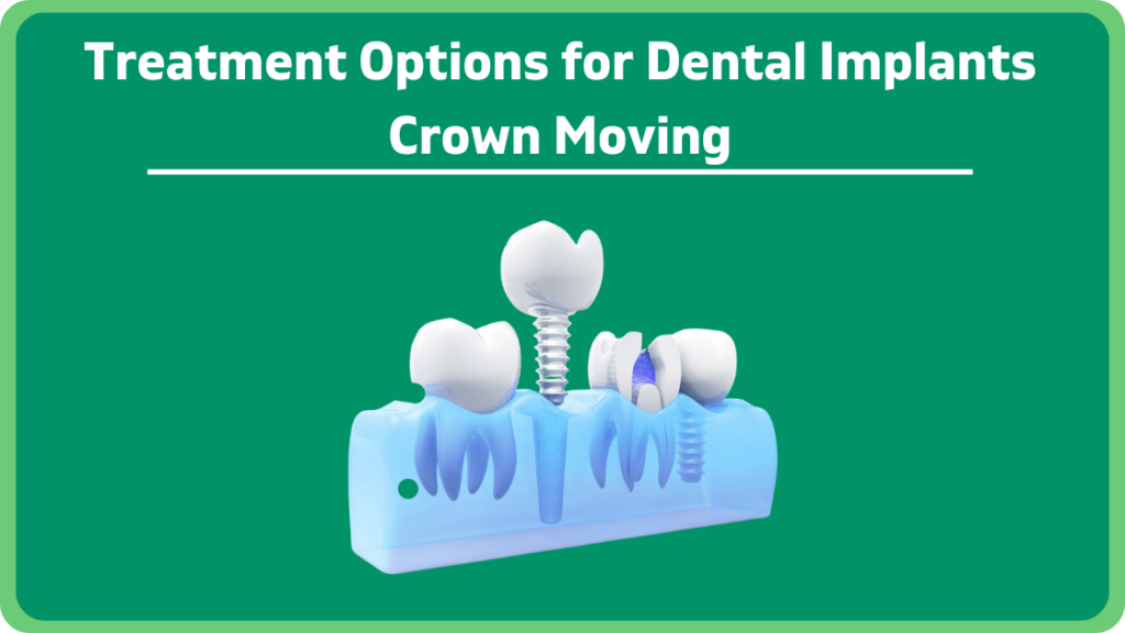 Treatment Options for Dental Implants Crown Moving