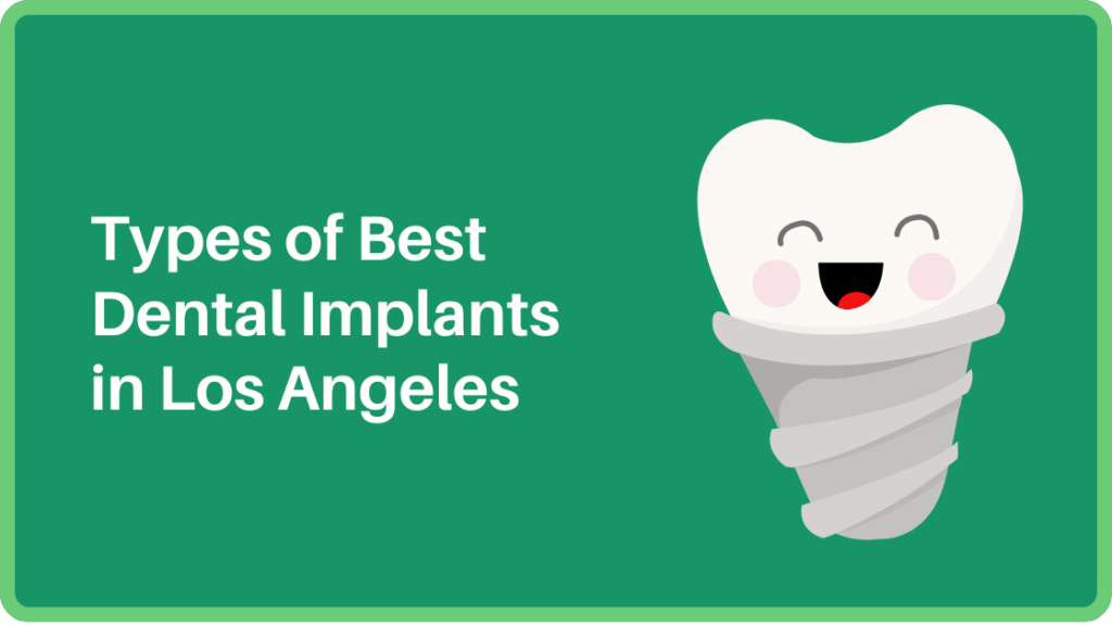 Types of Best Dental Implants in Los Angeles