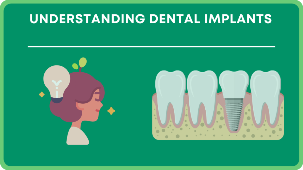 Understanding Dental Implants 