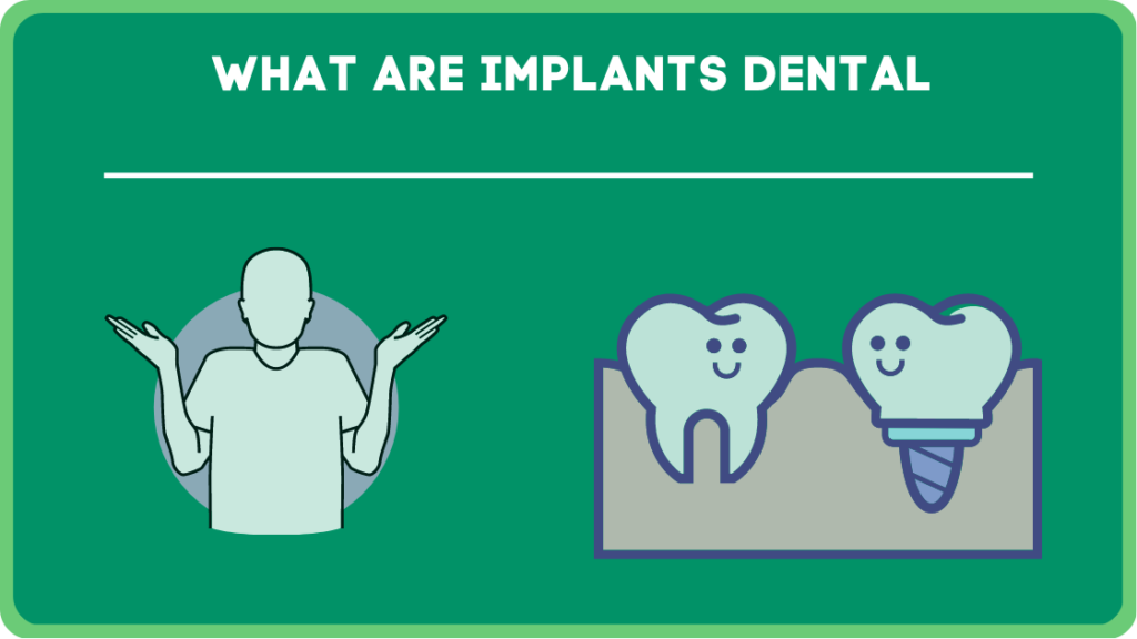 What are Implants Dental