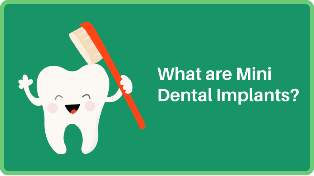 What are Mini Dental Implants?