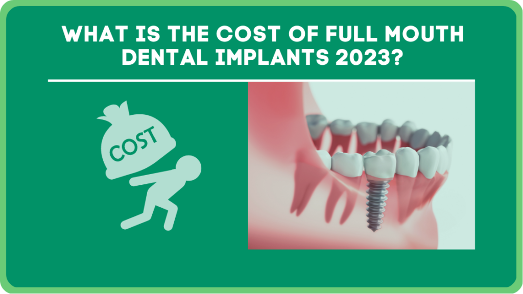 What is The Cost of Full Mouth Dental Implants 2023