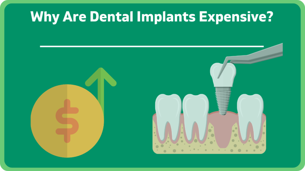 Why Are Dental Implants Expensive