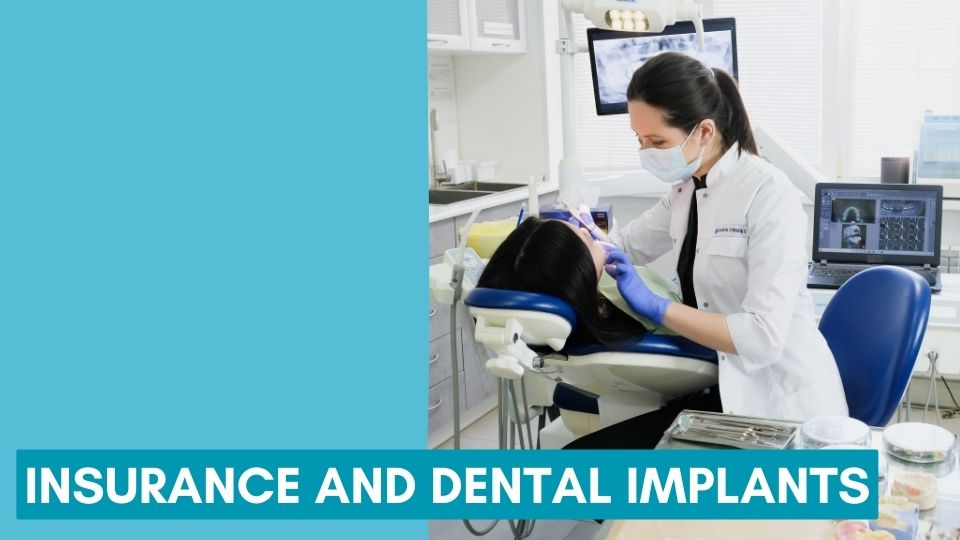 Insurance and Dental Implants
