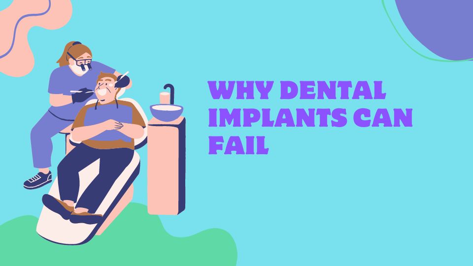 Why Dental Implants Can Fail