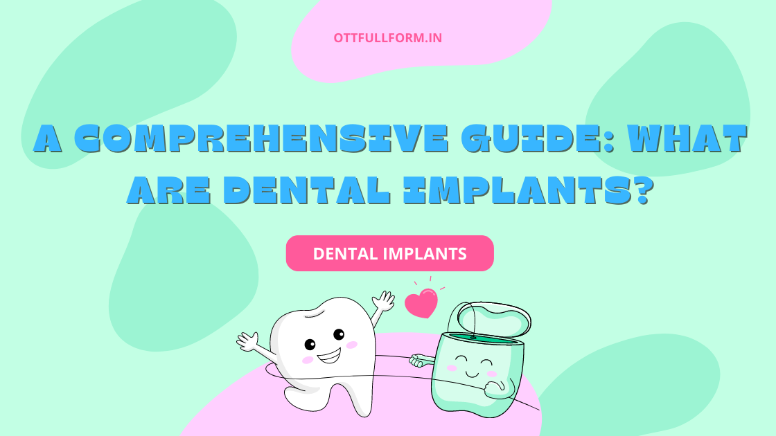 A Comprehensive Guide: What are Dental Implants?