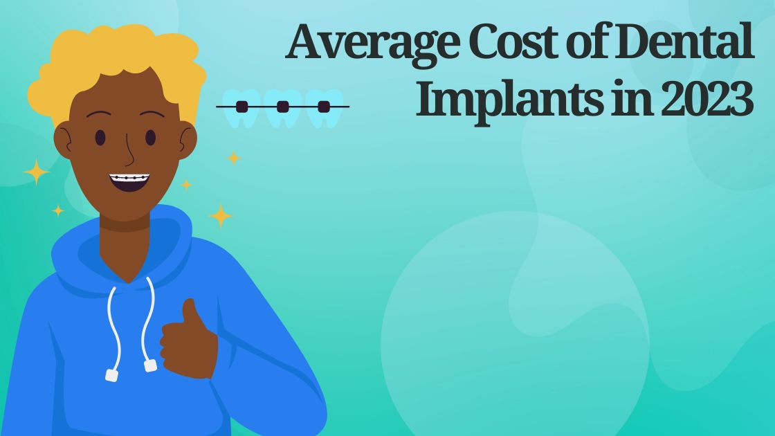 Average Cost of Dental Implants in 2023