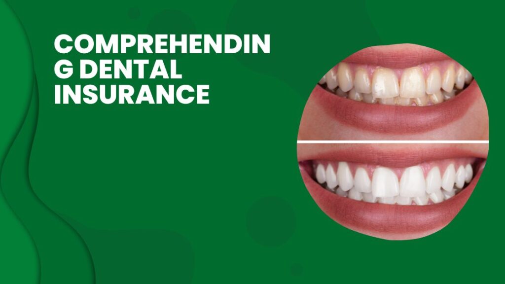 Comprehending Dental Insurance