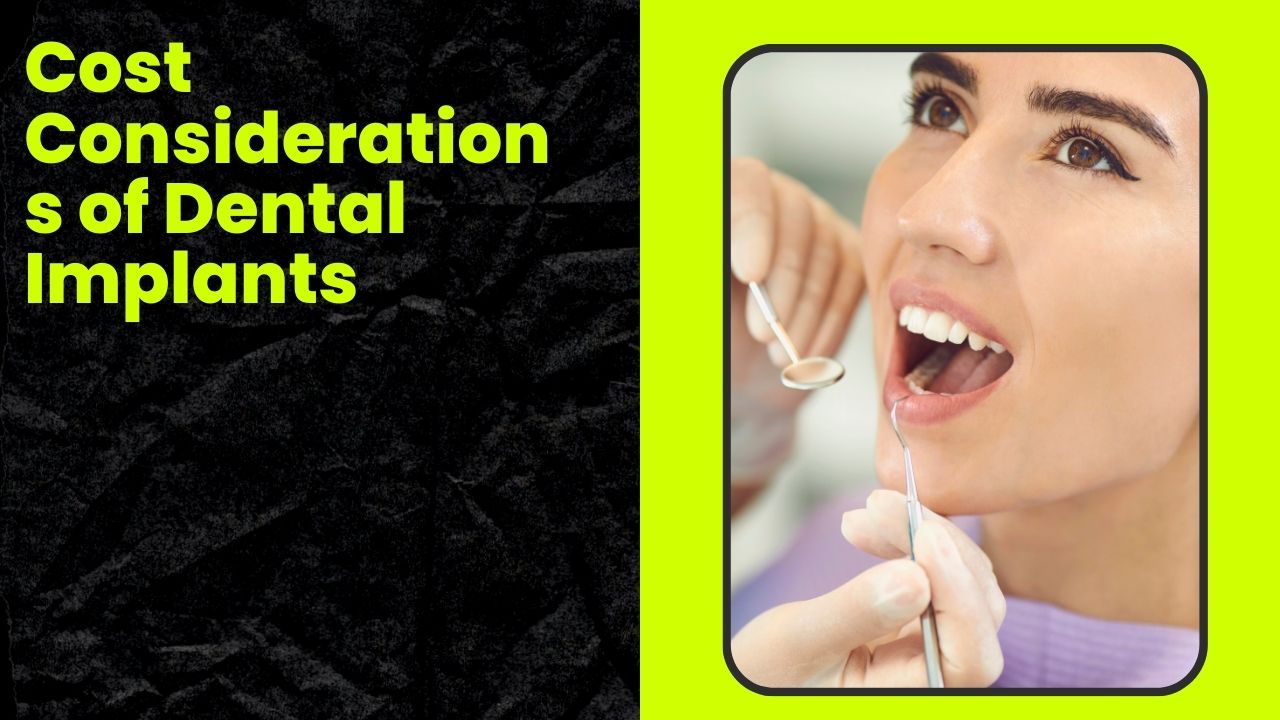 Cost Considerations of Dental Implants