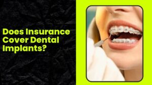 Does Insurance Cover Dental Implants?
