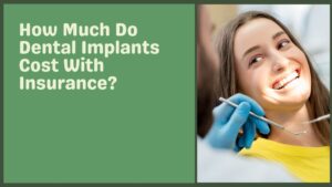 How Much Do Dental Implants Cost With Insurance?