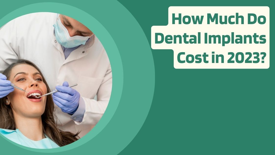 How Much Do Dental Implants Cost in 2023