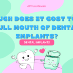 How Much Does It Cost to Get a Full Mouth of Dental Implants?
