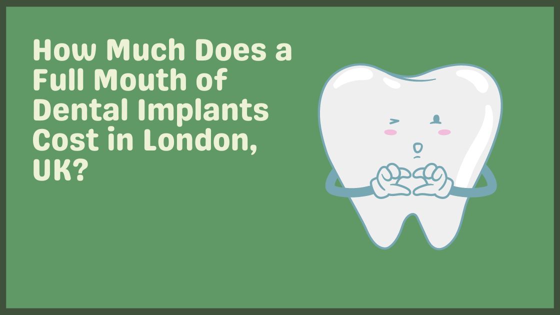 How Much Does a Full Mouth of Dental Implants Cost in London