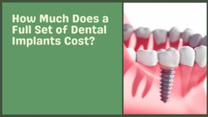 How Much Does a Full Set of Dental Implants Cost