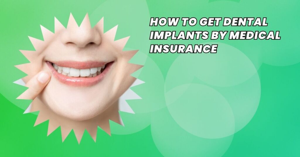 How to Get Dental Implants by Medical Insurance