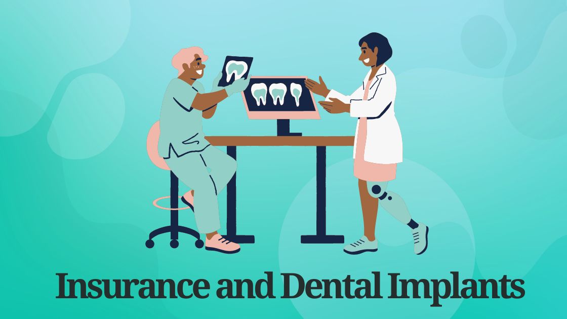 Insurance and Dental Implants