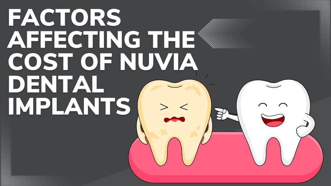 The Average Cost of Nuvia Dental Implants