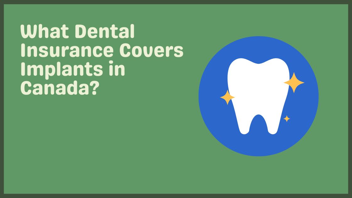 What Dental Insurance Covers Implants in Canada?