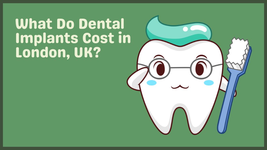 What Do Dental Implants Cost in London