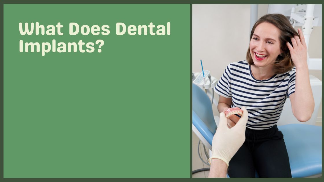 What Does Dental Implants