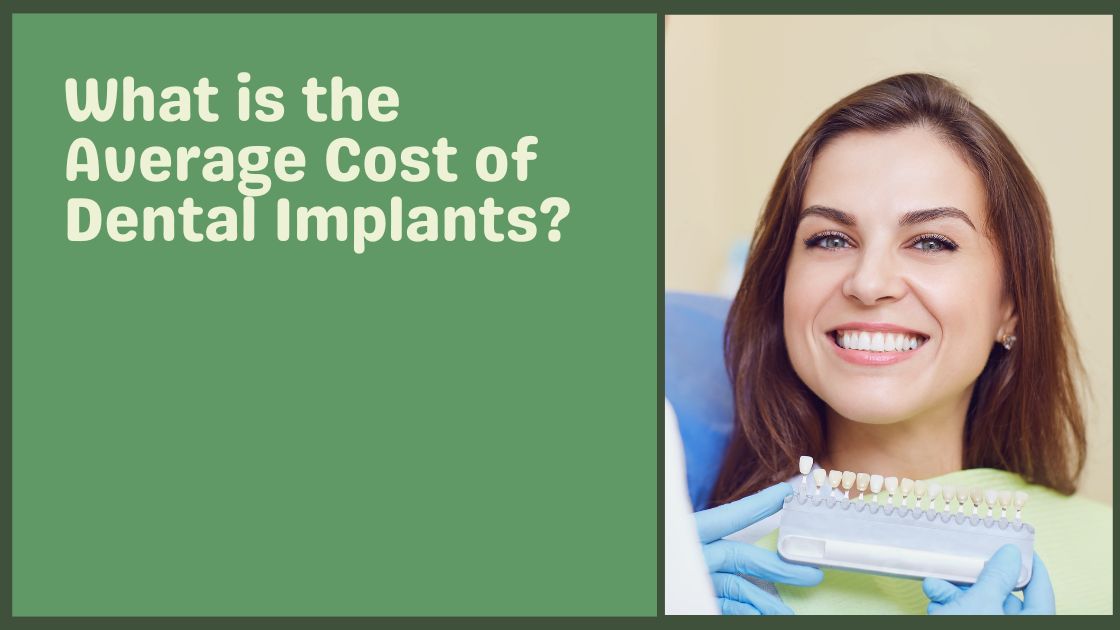 What is the Average Cost of Dental Implants