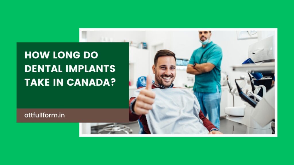 How Long Do Dental Implants Take in Canada?