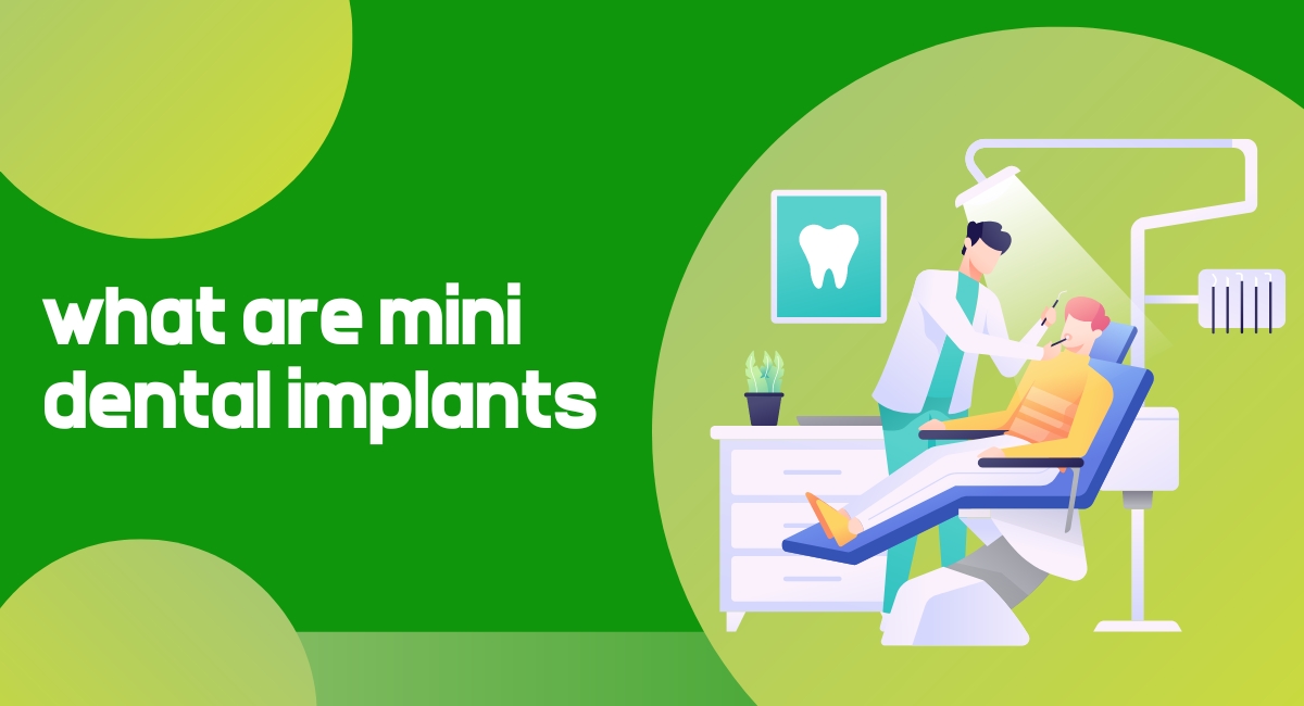 how to find best information about what are mini dental implants is very easy we add all information about what are mini dental implants