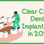 Clear Choice Dental Implant Cost in 2024