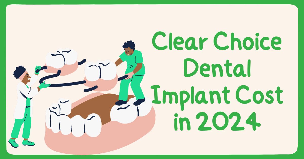 Clear Choice Dental Implant Cost in 2024