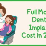 Full Mouth Dental Implants Cost in 2024